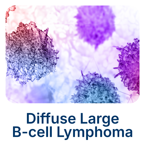 Diffuse Large B-Cell Lymphoma Diffuse Large B-Cell Lymphoma