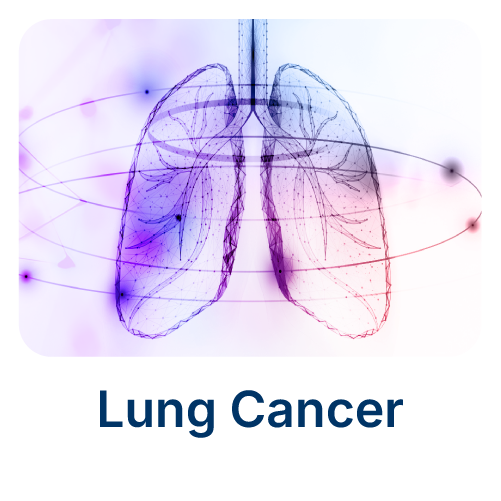 Lung Cancer Lung Cancer